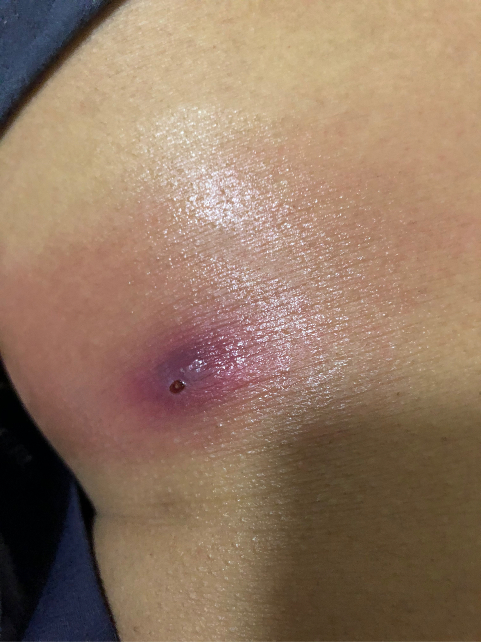 皮肤科医生李志忠