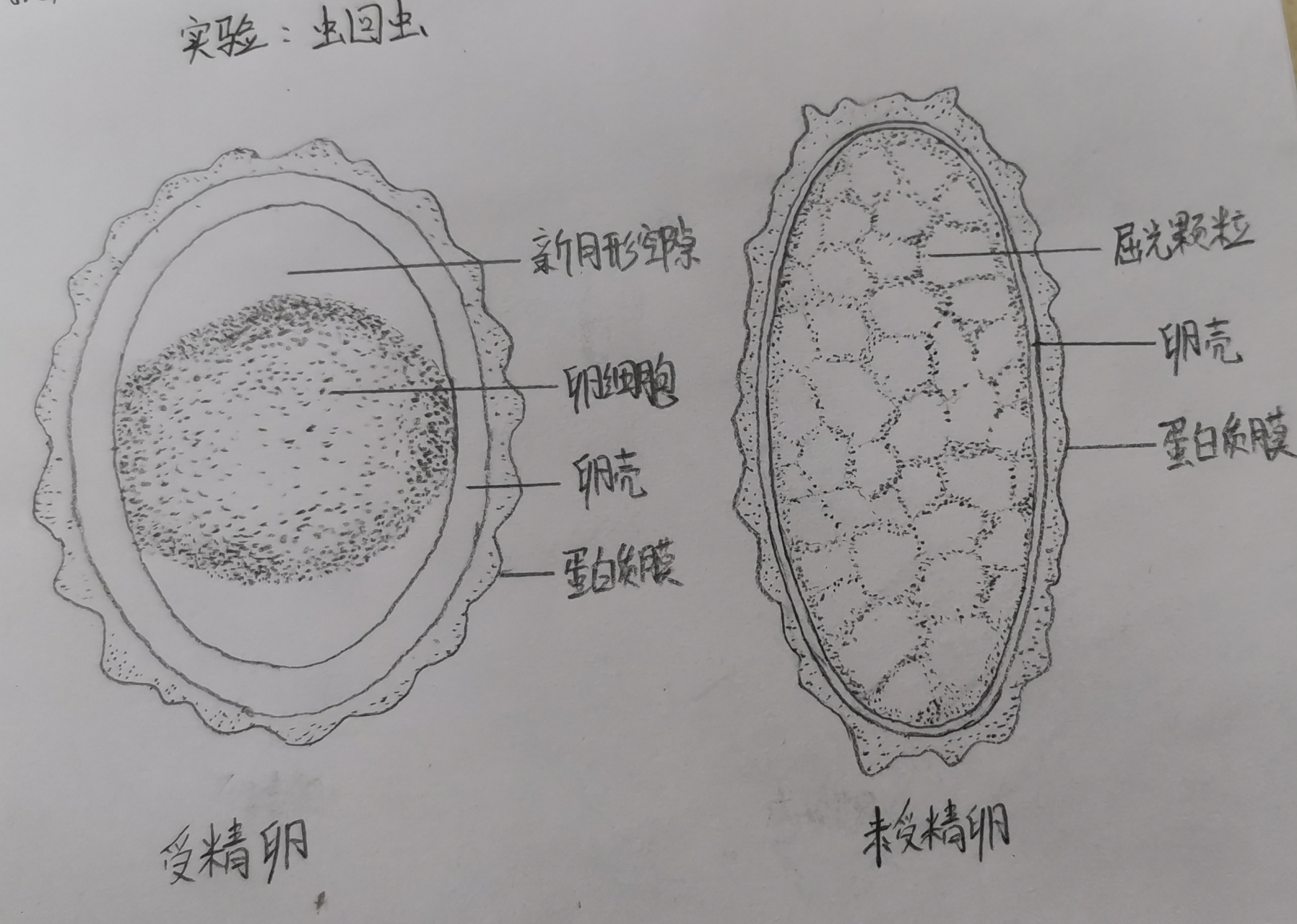 寄生虫蛔虫手绘图 寄生虫蛔虫手绘图