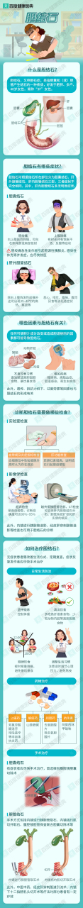 【百度健康医典-权威医学图解】 今天典典来科普"胆结石",本图由复旦