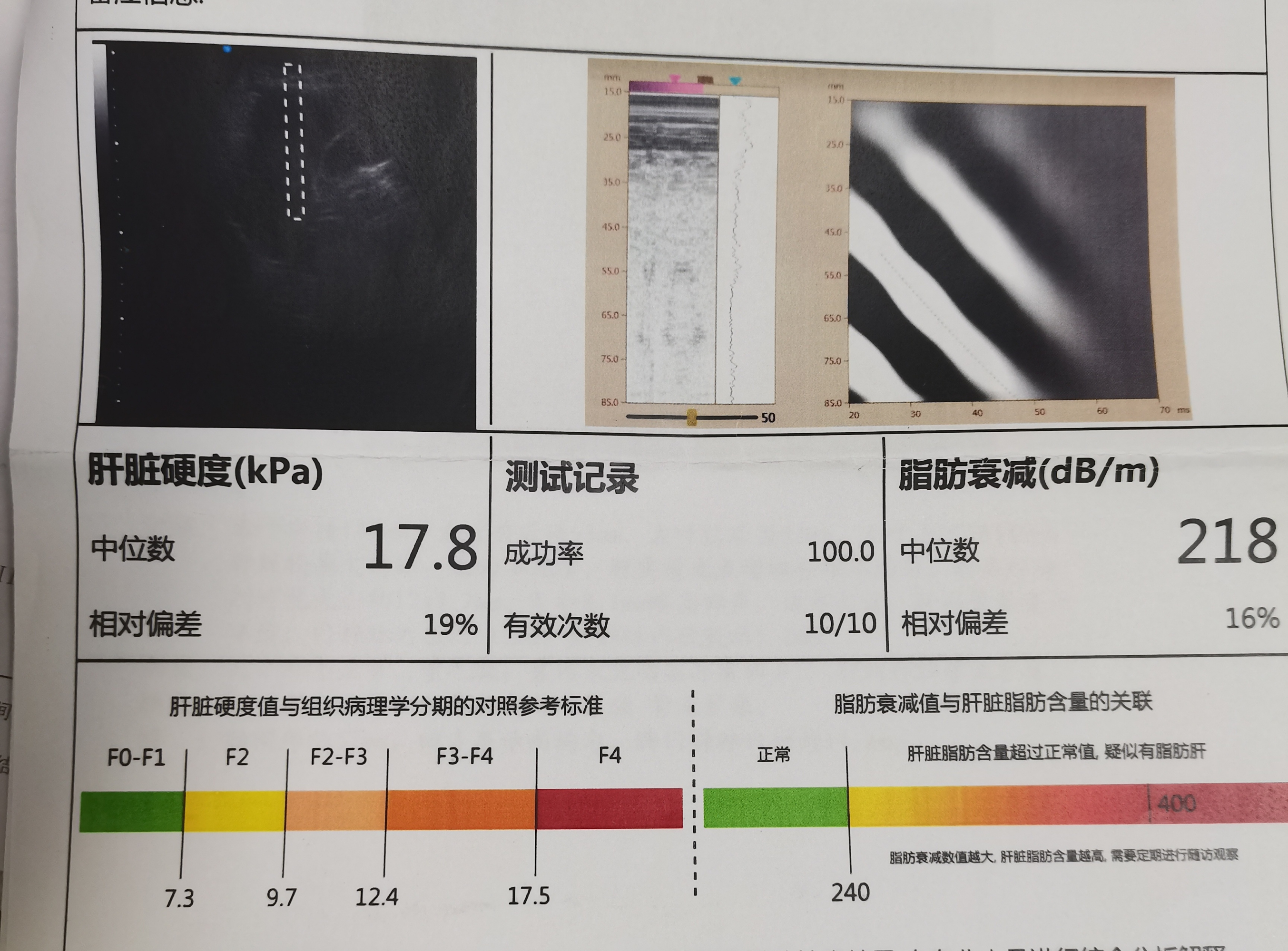 关于佑安医院代挂专家号服务精准对接专科诊疗,就医更具针对性的信息 关于佑安医院代挂专家号服务精准对接专科诊疗,就医更具针对性的信息