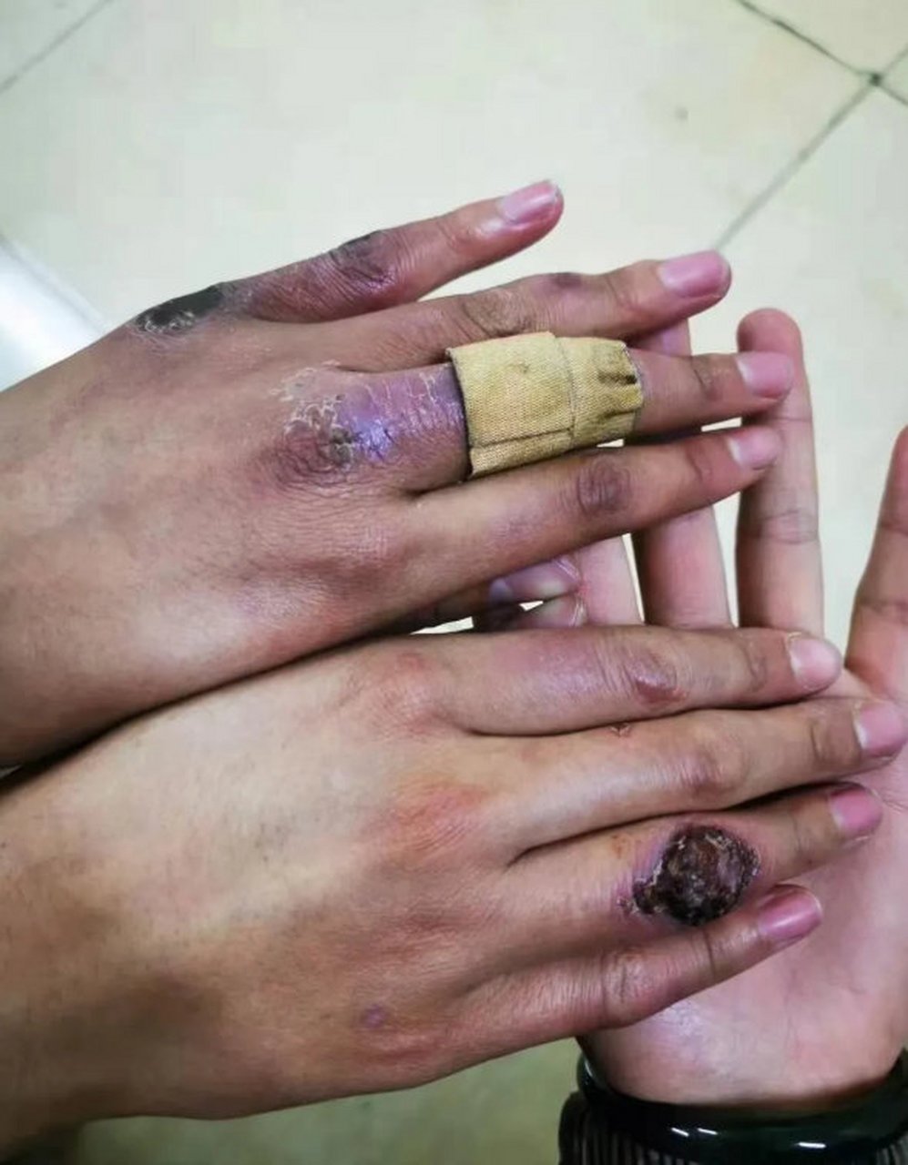 这是一双西藏边防女战士的手,看着让人心疼