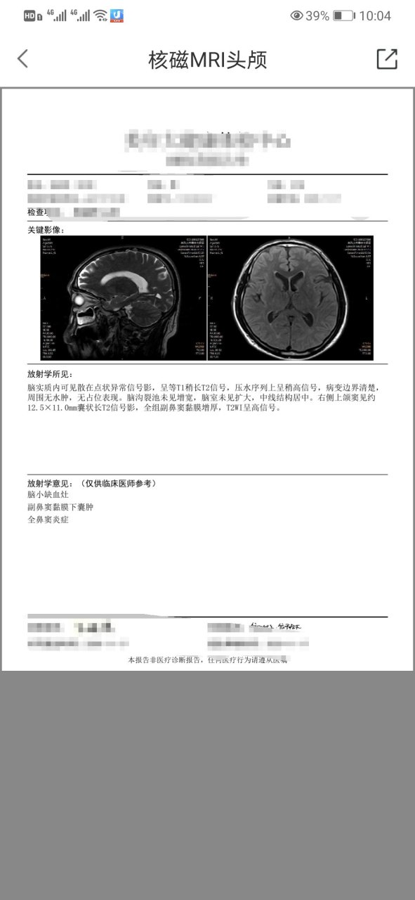 体检做头部核磁共振,结果为"脑小缺血灶,刚开始有点紧张,难道是脑梗