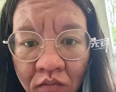 女子晒出自己怀孕前后的脸部变化,我的天,这还是一个人吗?