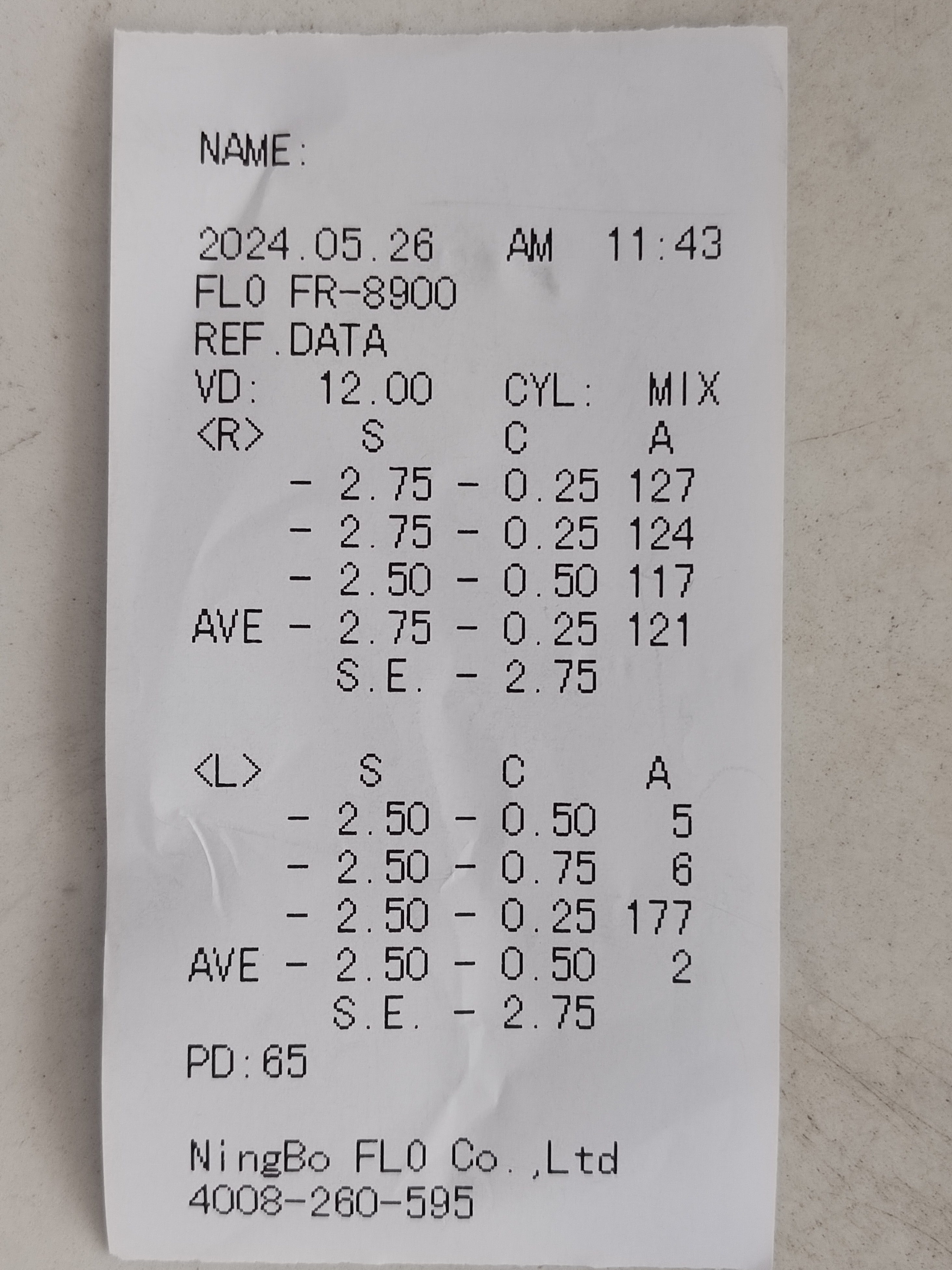 15岁的找客户眼镜佩戴1年多了右眼涨50度,左眼涨了25度,exo外斜视2△!