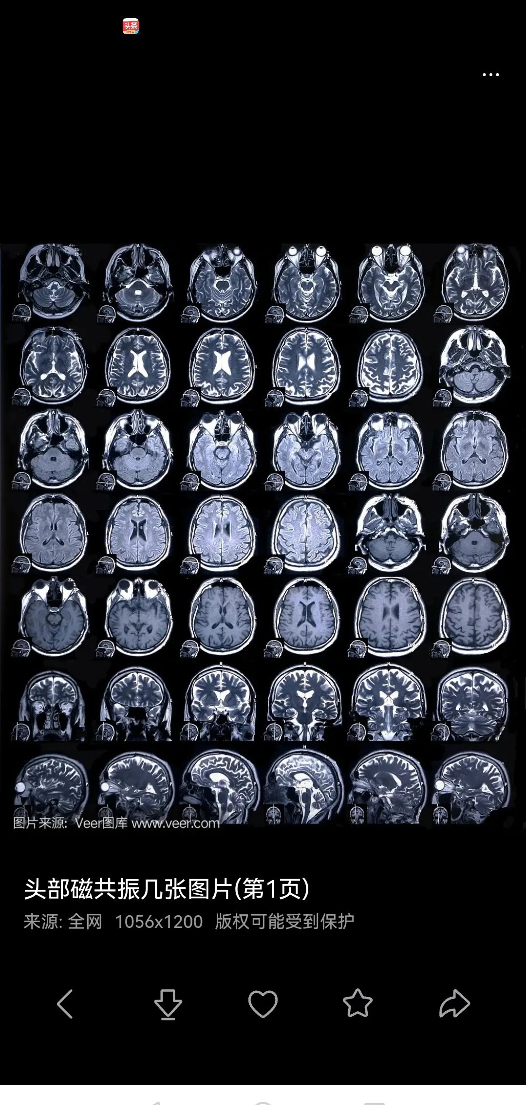 核磁共振头部检测正常图片颅脑磁共振图片脑部的ct大脑侧面ct结构图脑