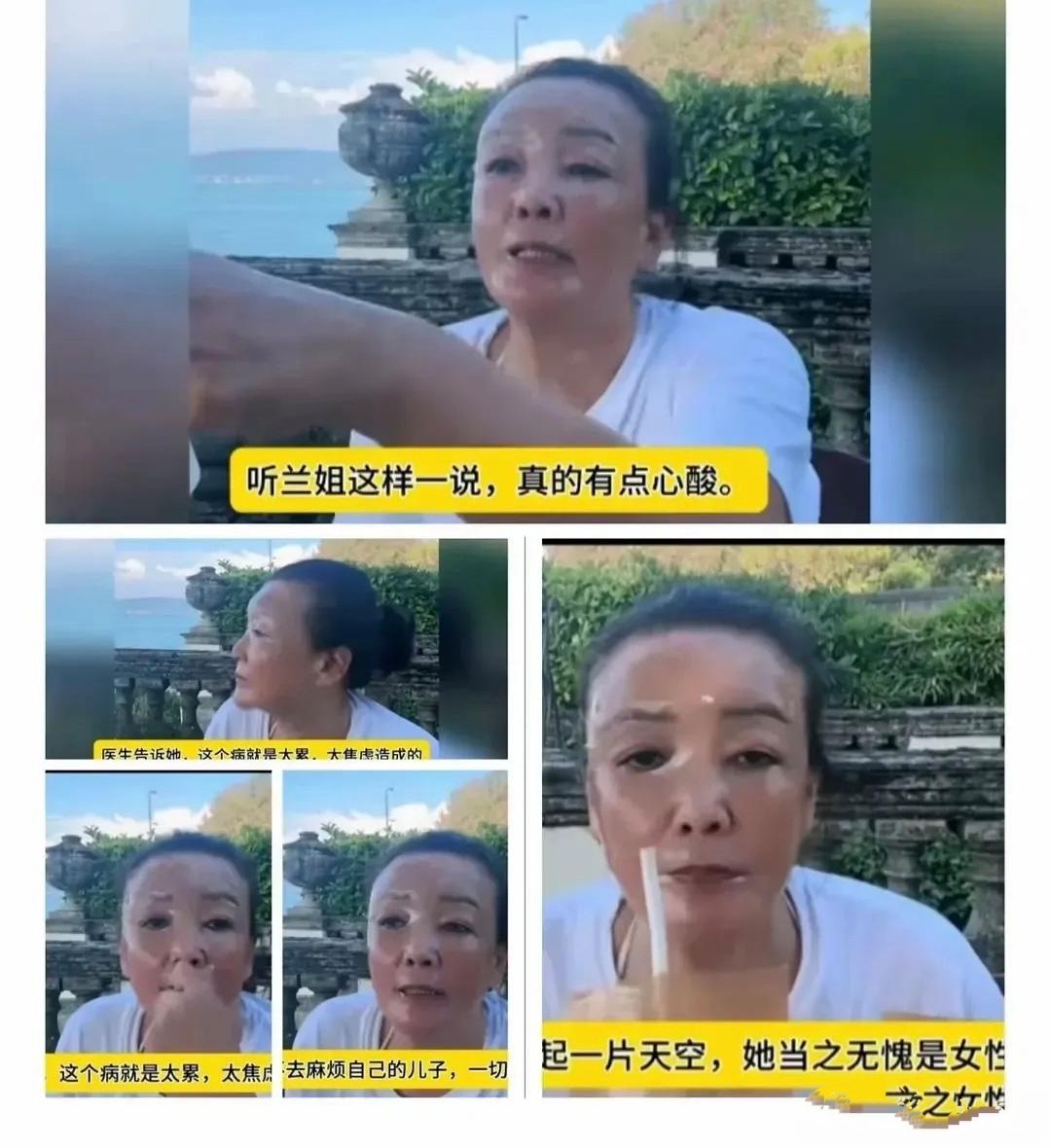 俏江南张兰女士如今面目全非!医生说和他过度操劳是分不开的!