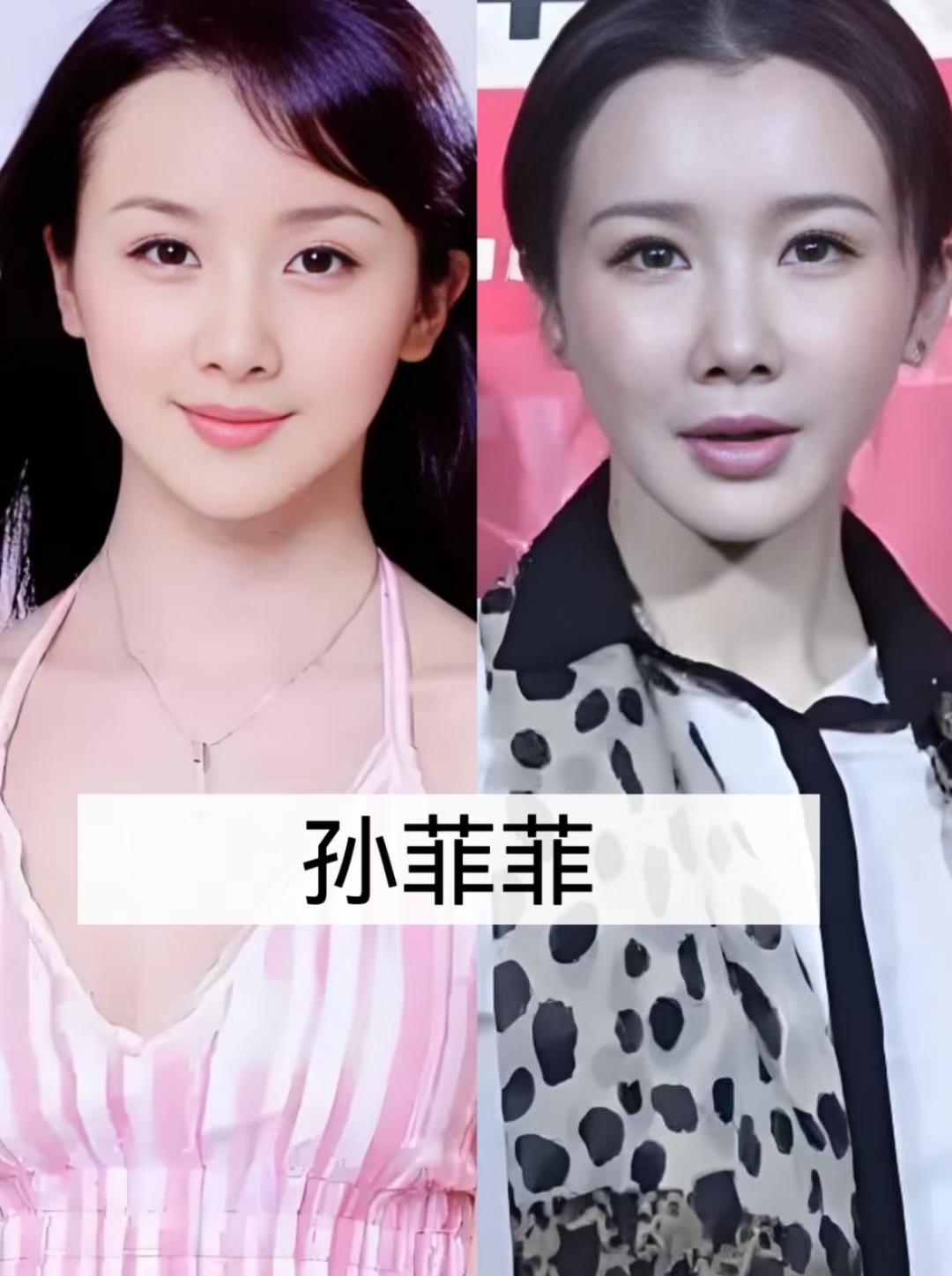 部分明星整容前,五官或许存在不够精致,面部轮廓不够流畅等问题,在