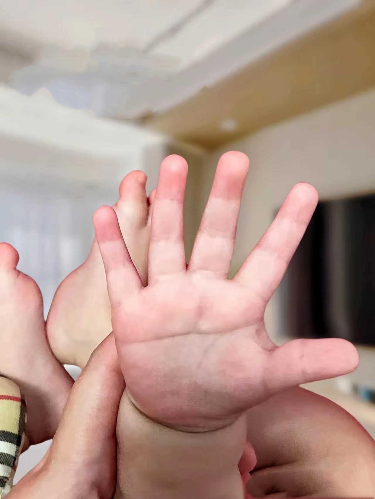 在老家,我们听过"断掌"是富贵的象征,但看到医生的严肃,我们很担心.