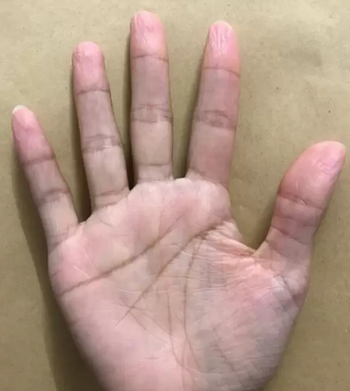 你的手相上出现了断断续续的健康线,健康线就是冲向小指的线路,没有