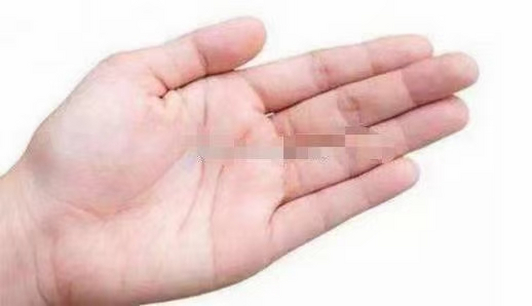 多财帛纹财帛纹也称为钱财纹,是指在小指和无名指中间下方的短小斜线.
