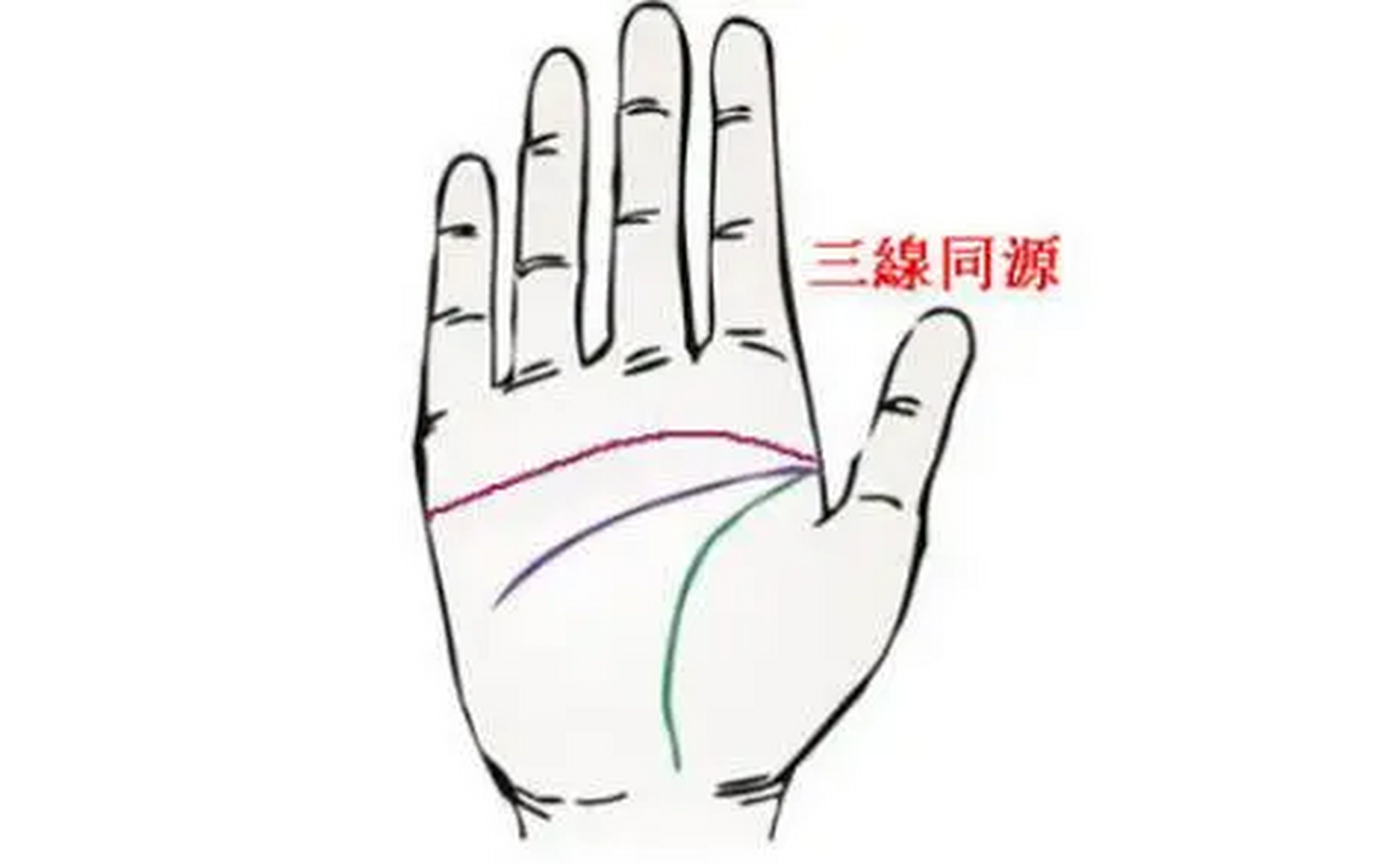 手掌三线同源 也就是感情线,智慧线,生命线,三条线同源而出.