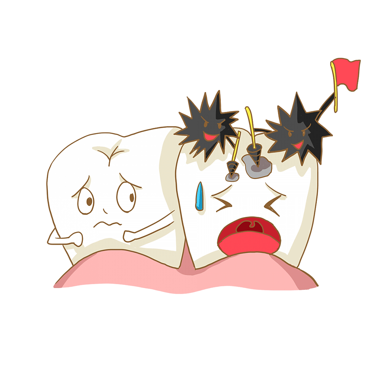 导致虫牙的细菌以糖类为"食物",经过一系列反应在牙齿表面形成牙景哌