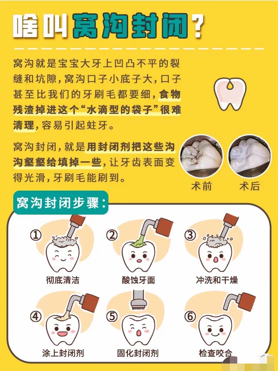 窝沟封闭手抄报图片