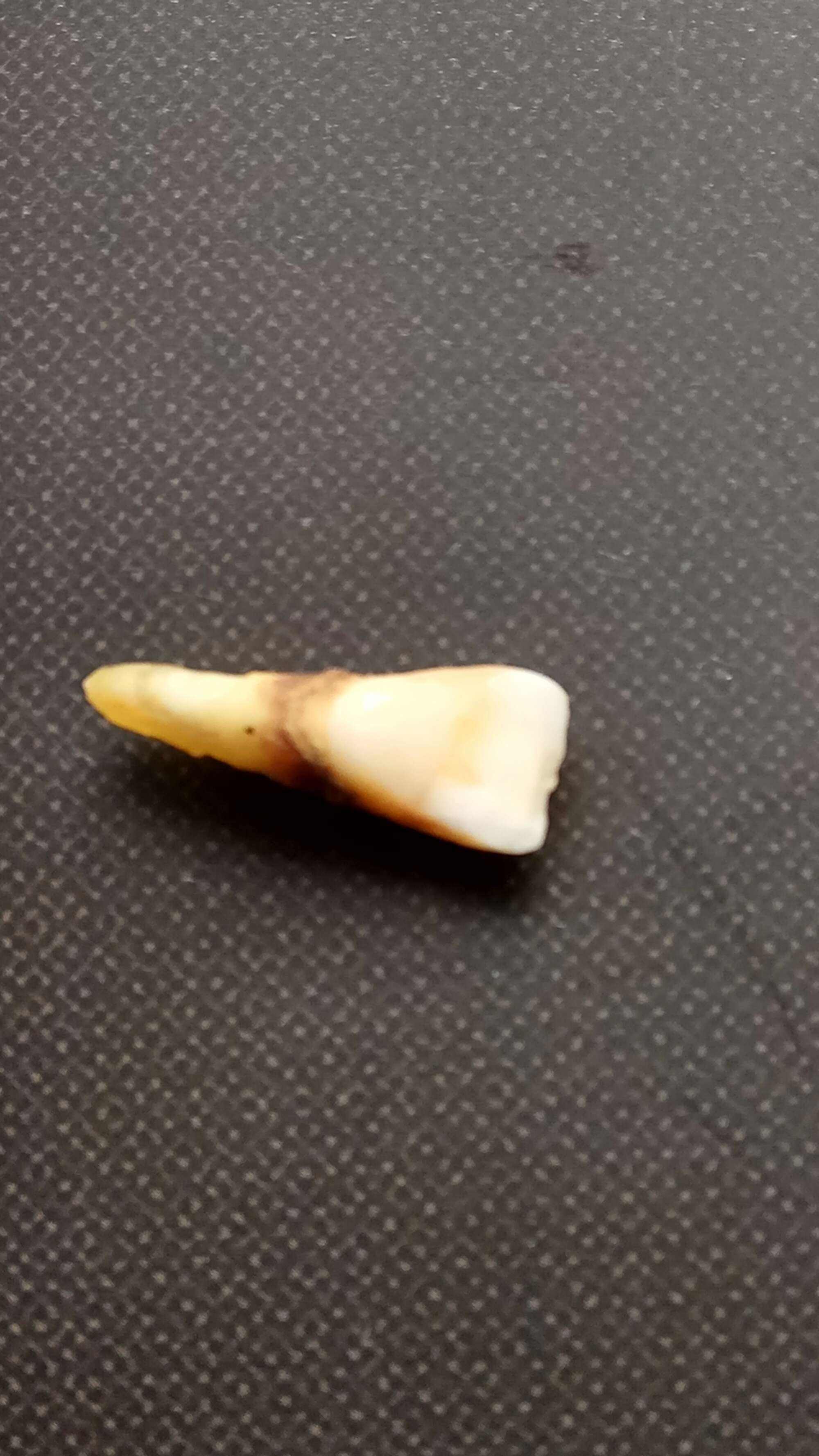 男子打球时磕掉对方2颗牙,6天后发现牙竟然卡在男子头顶,散场后大家在