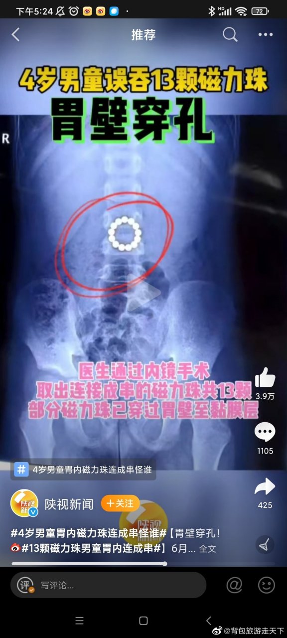 小孩吃磁力珠处理方法=孩子误食磁力珠一颗能不能排出