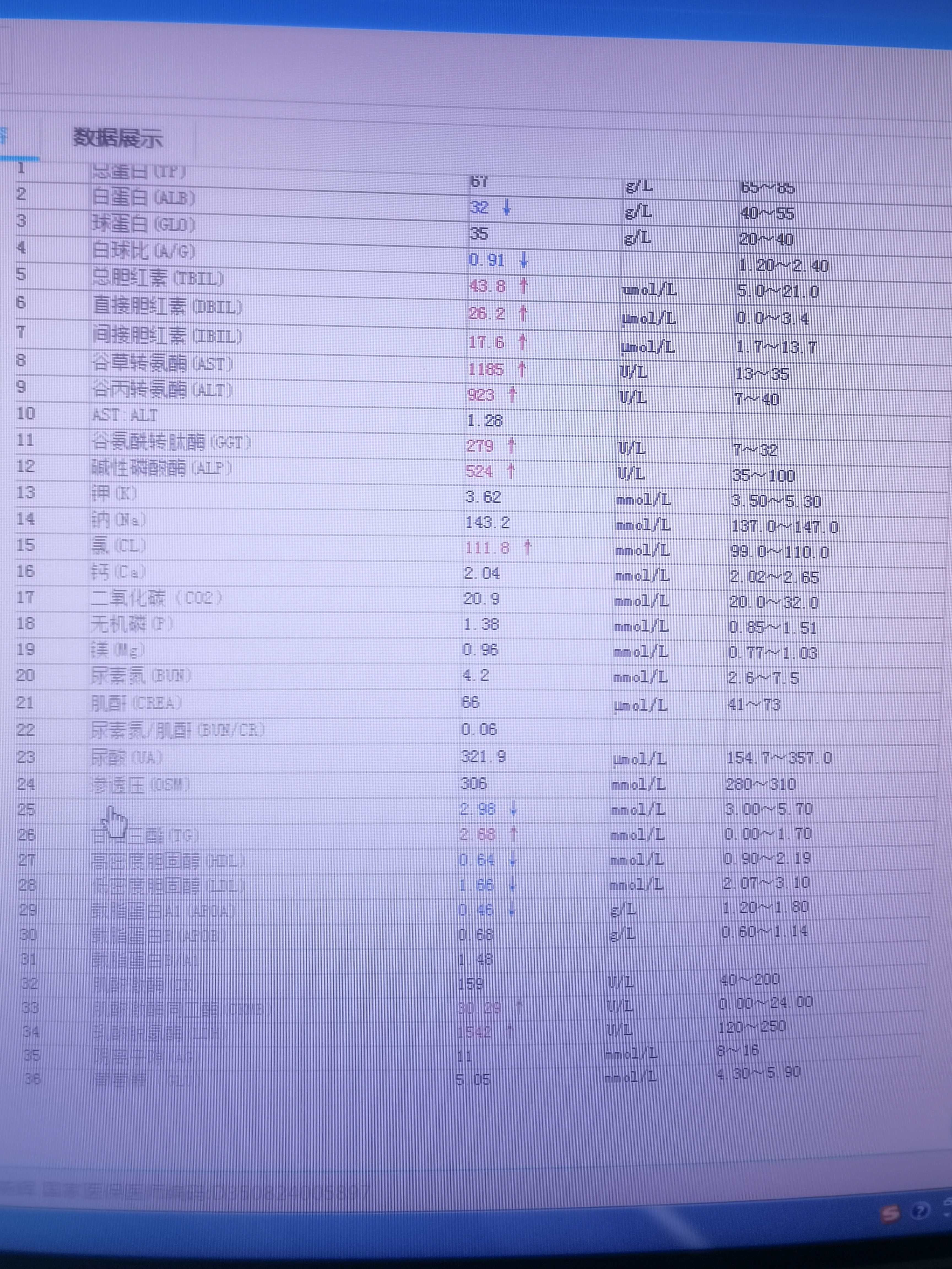 恙虫病立克次体绘图图片