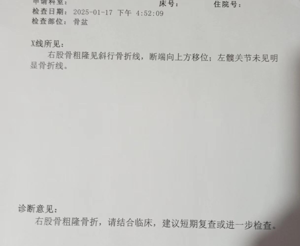惨  昨天发生了惊天惨案,老娘又骨折了,本来应该写