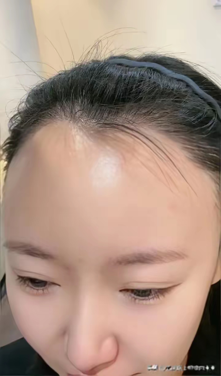 不仅会显得发际线过高,头发再浓密也挡高额头额头高的女人适合什么