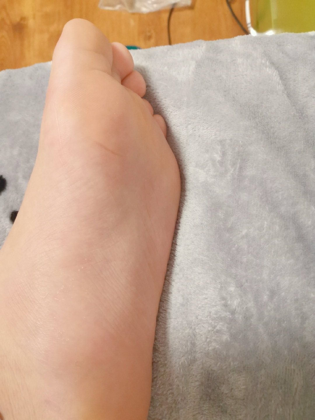 12岁男孩脚底图片 有什么问题吗?