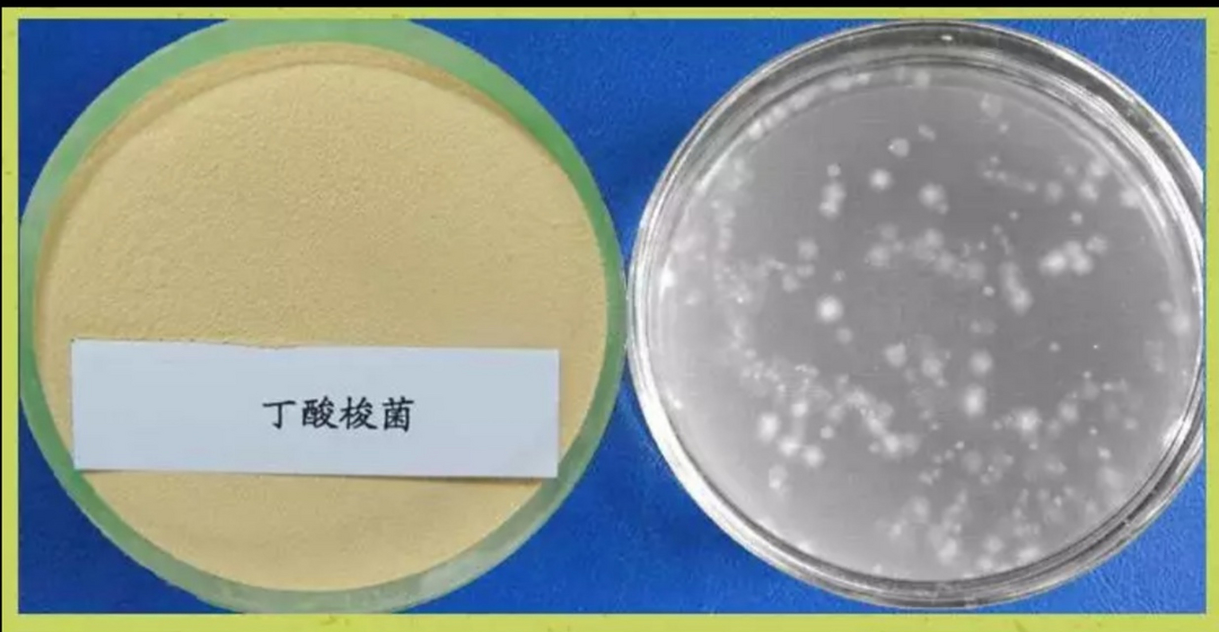 1,丁酸梭菌是1933年一个日本宫入近治博士发现的并报告的,名为革兰氏