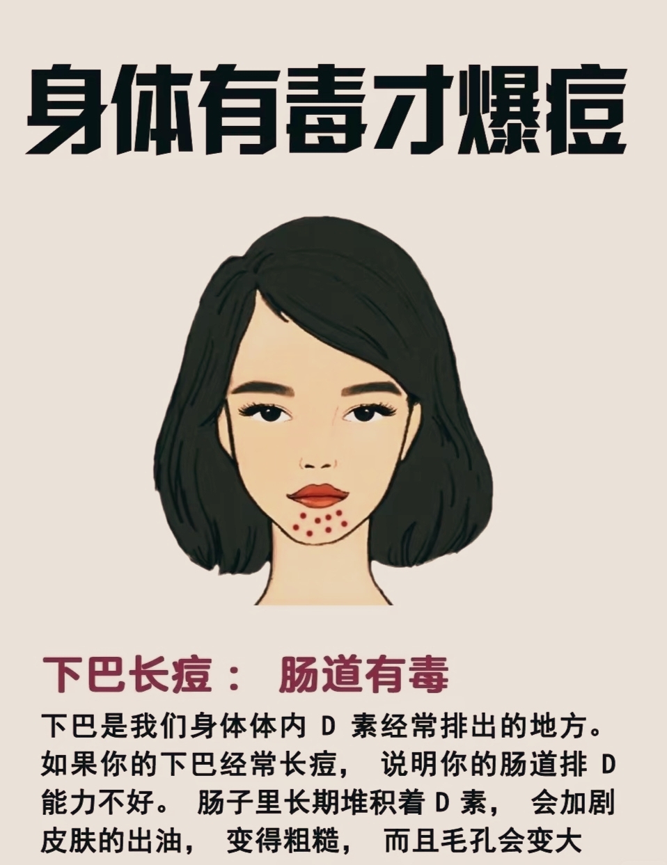 下巴长痘示肠毒,排毒不畅致油糙孔大