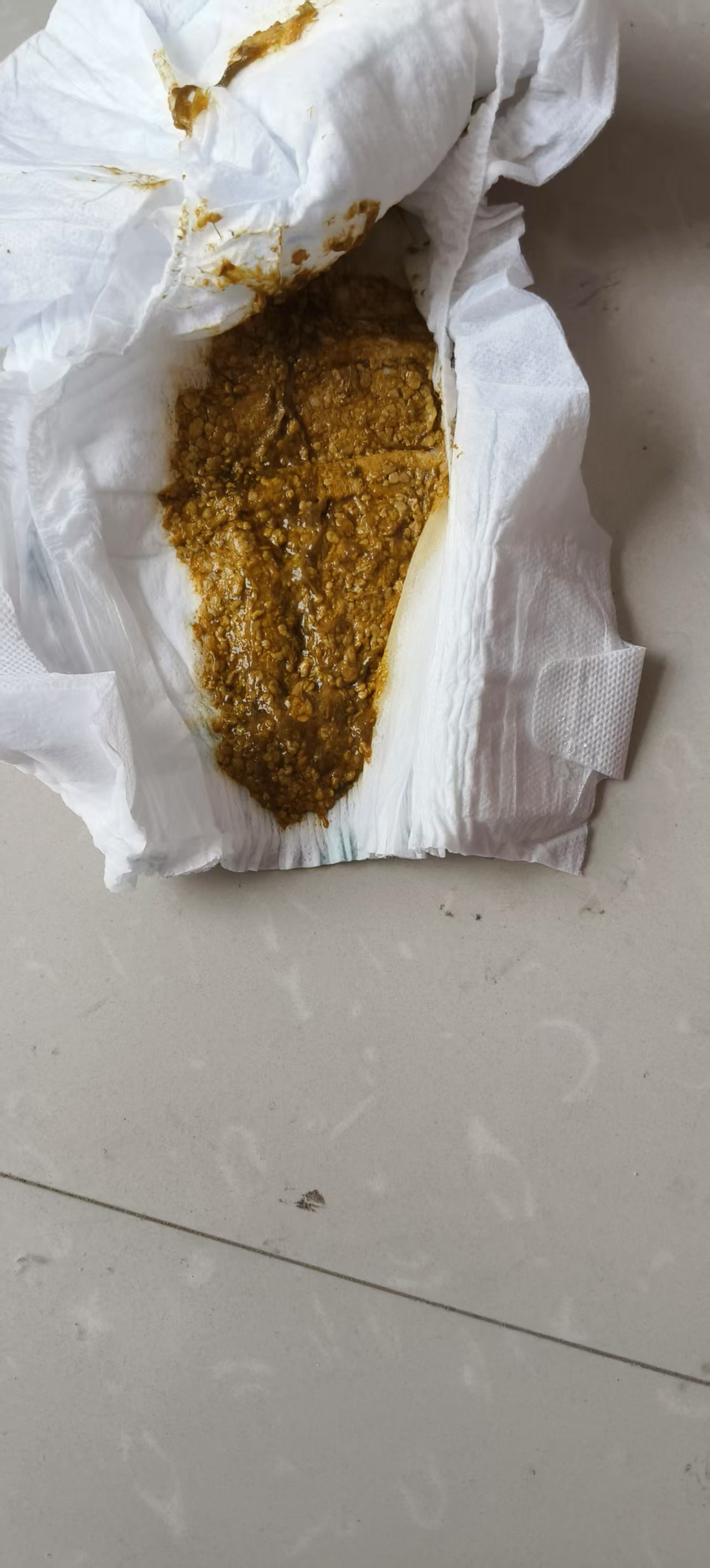 4个月宝宝拉的屎,我家全奶粉喂养,是不是消化不良