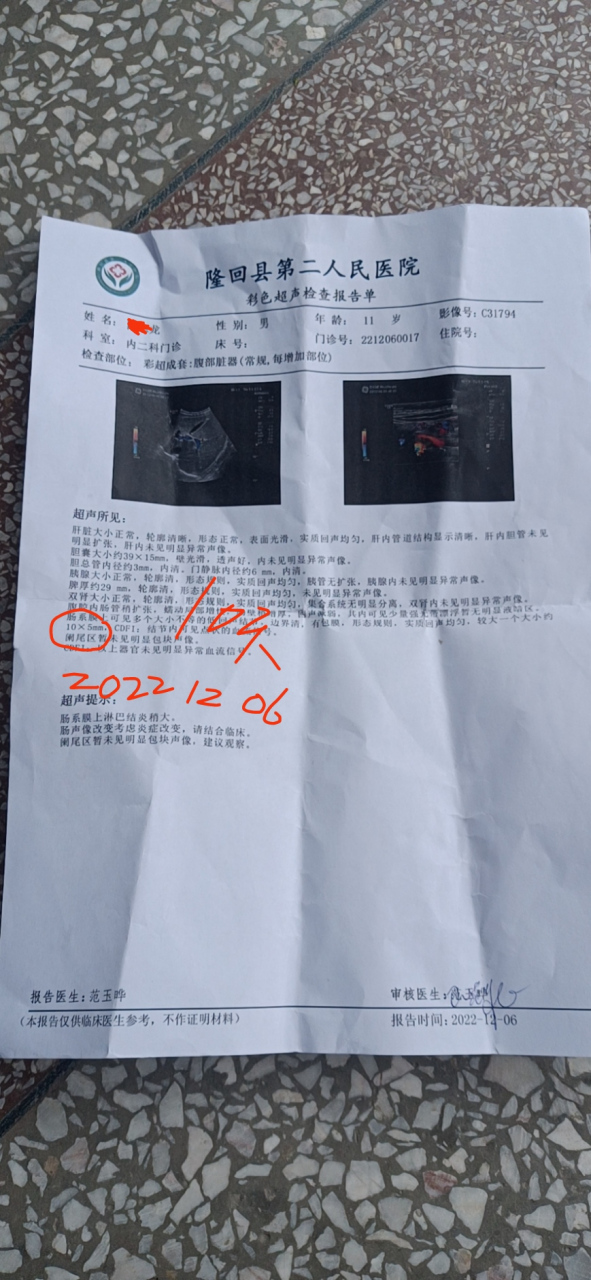 肠系膜淋巴结肿大10天的缩小对比