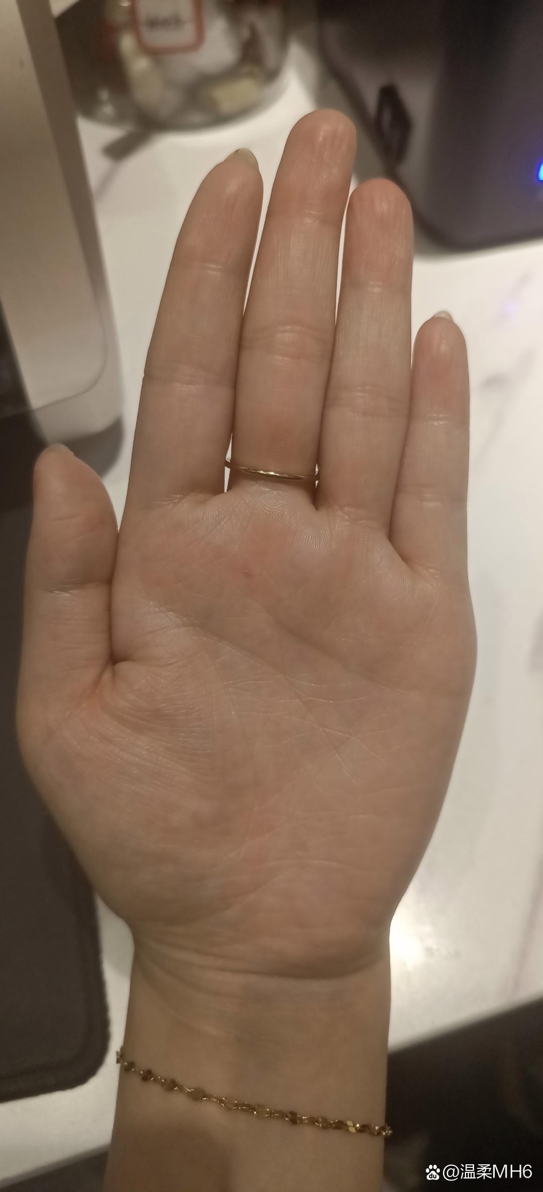 因为手背有颗黑痣,从小就被人说命不好,后面长大也感觉对运气不咋滴