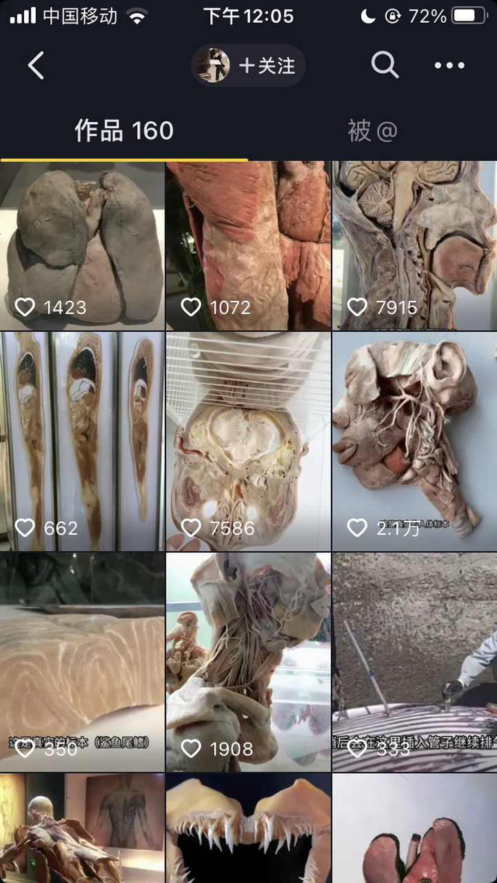 大体老师,最近推给我(好多账号) 脑部 小红心96 676767