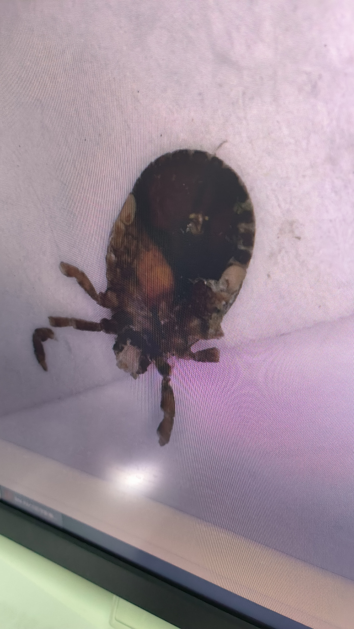 口器有没有断在皮肤里?