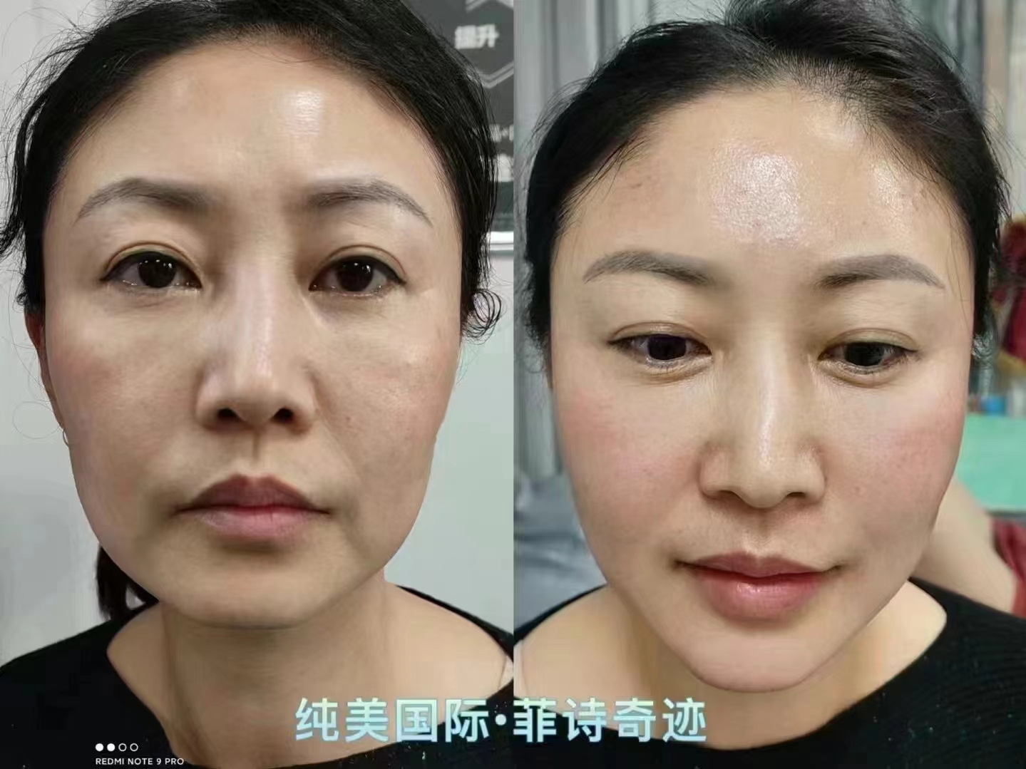 菲诗奇迹,创造奇迹!