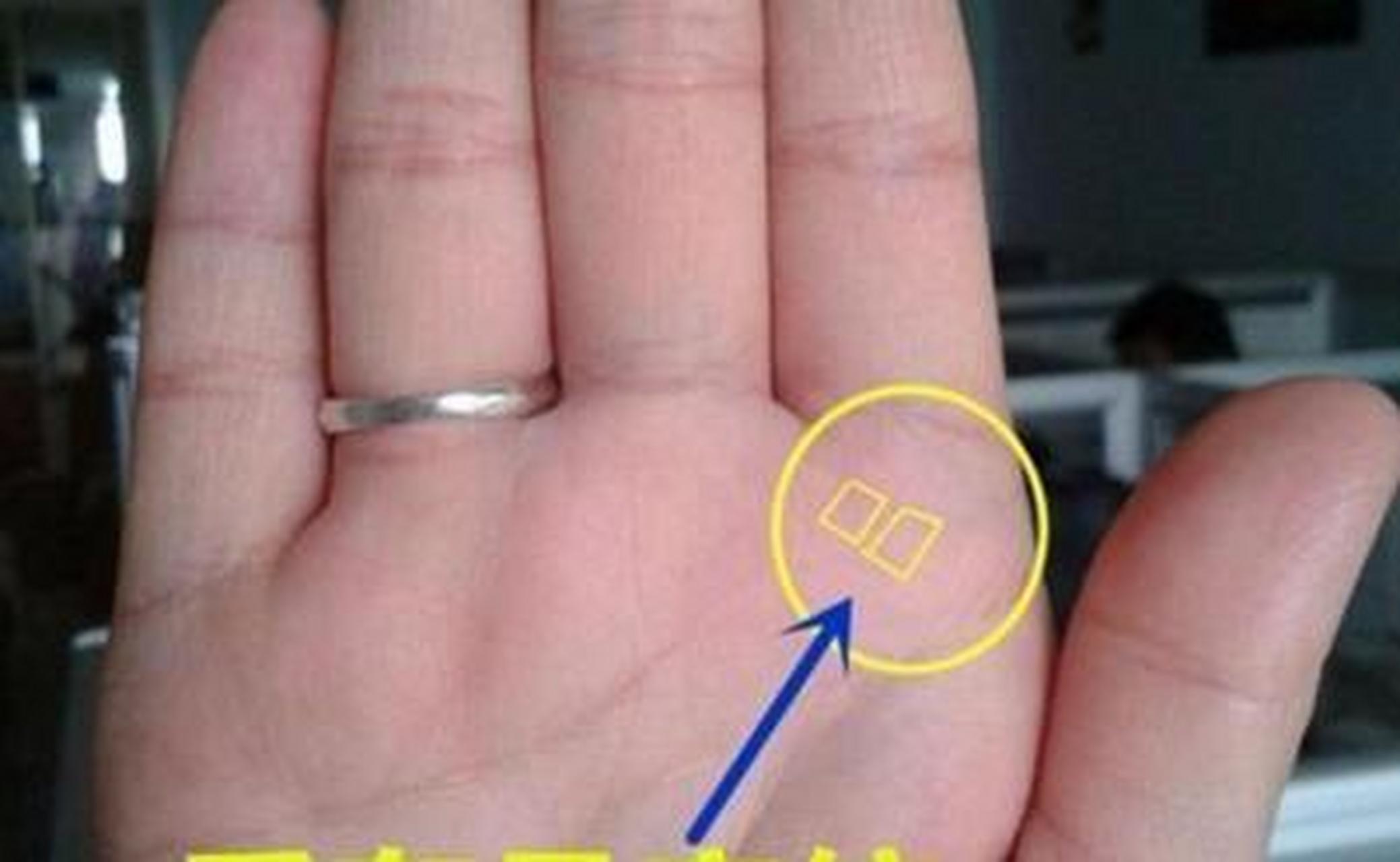 右手食指有痣的女人图片