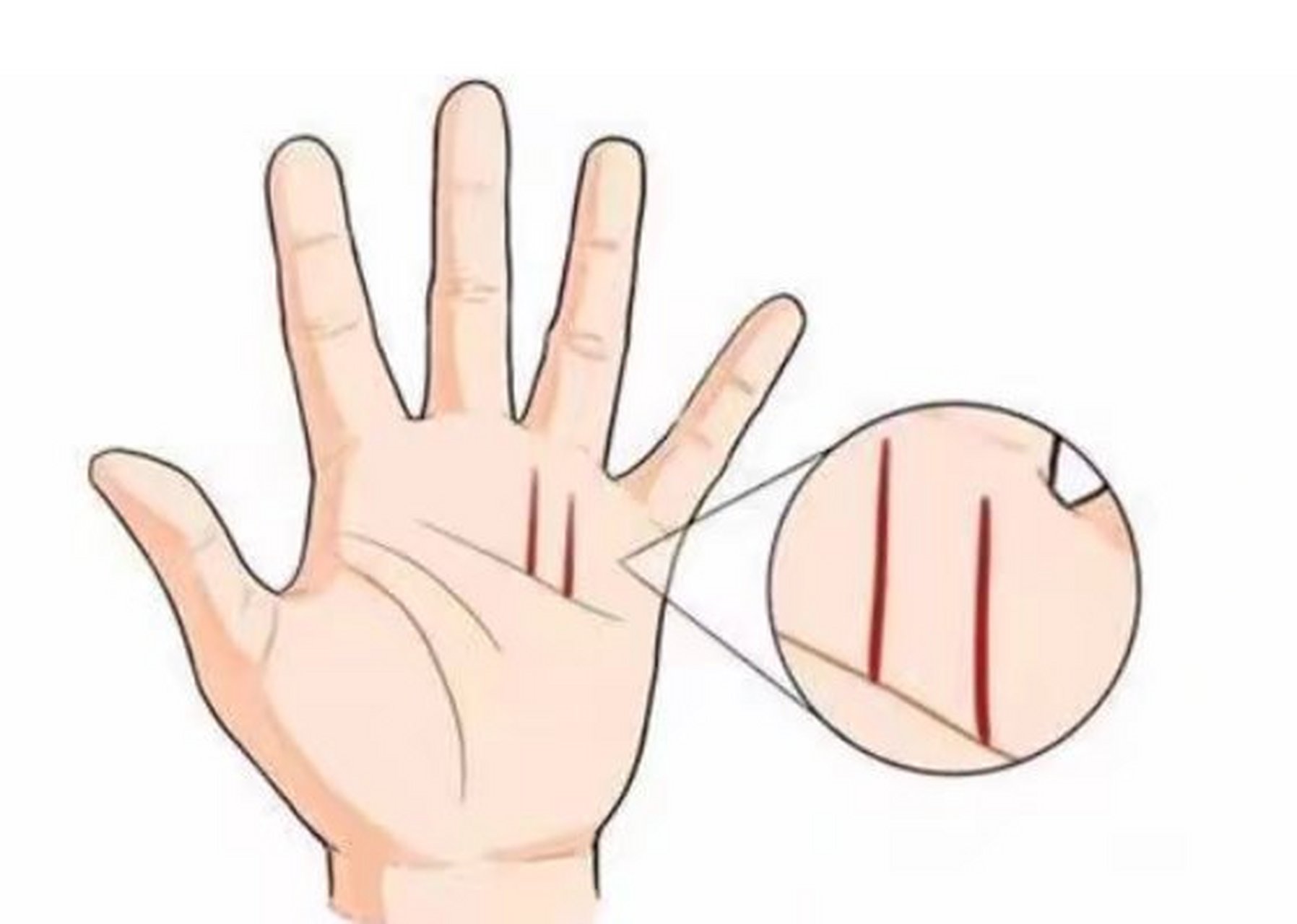 六秀纹短小细秀,在无名指之下呢有一条短短的六秀纹起于感情线之上.