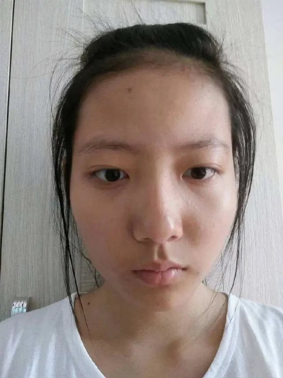 额头偏右上方有三颗呈三角形的痣  此类面相极其罕见,千年难遇.