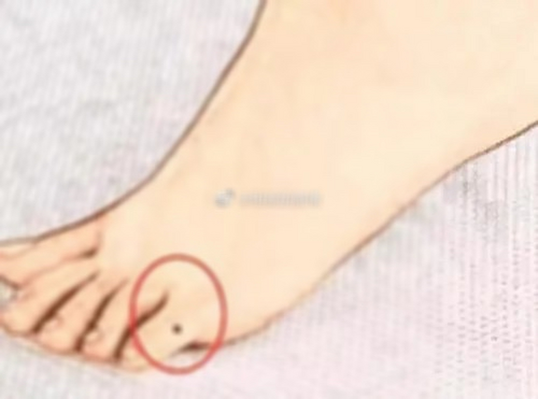 女人脚上的痣图解左右图片