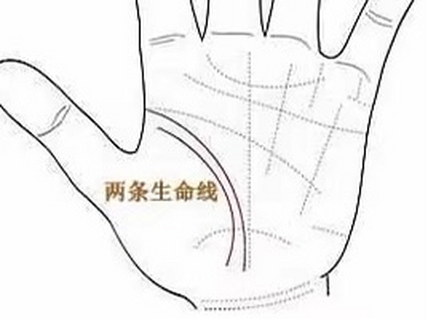 两条生命线  有些人有两条生命线,这往往意味着生命力顽强,特别在生病