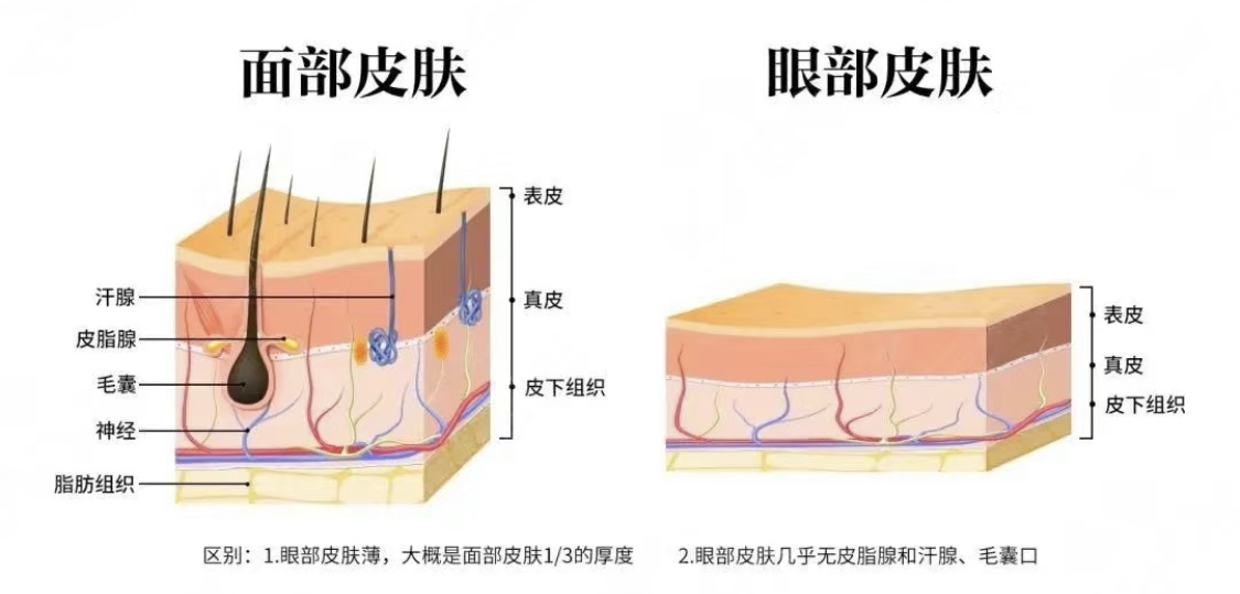 眼轮匝肌睑部图片