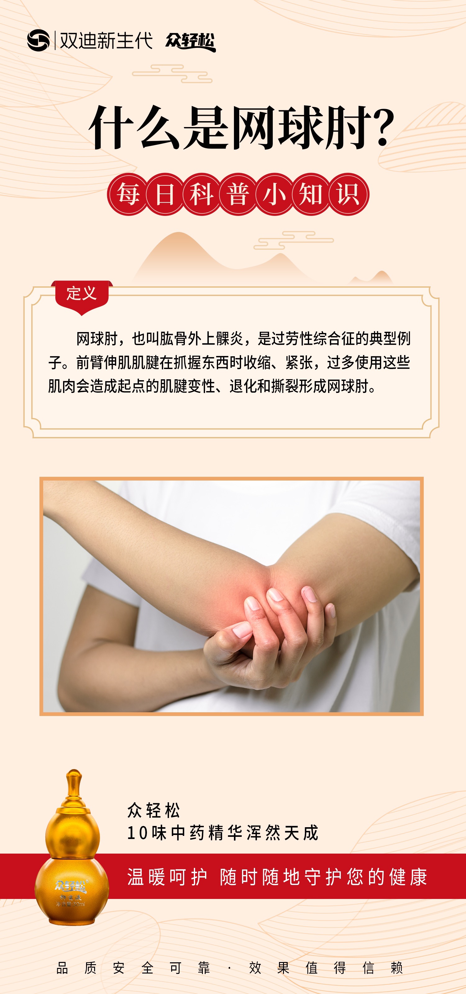 网球肘,也称为肱骨外上髁炎,是过劳性综合征的典型例子