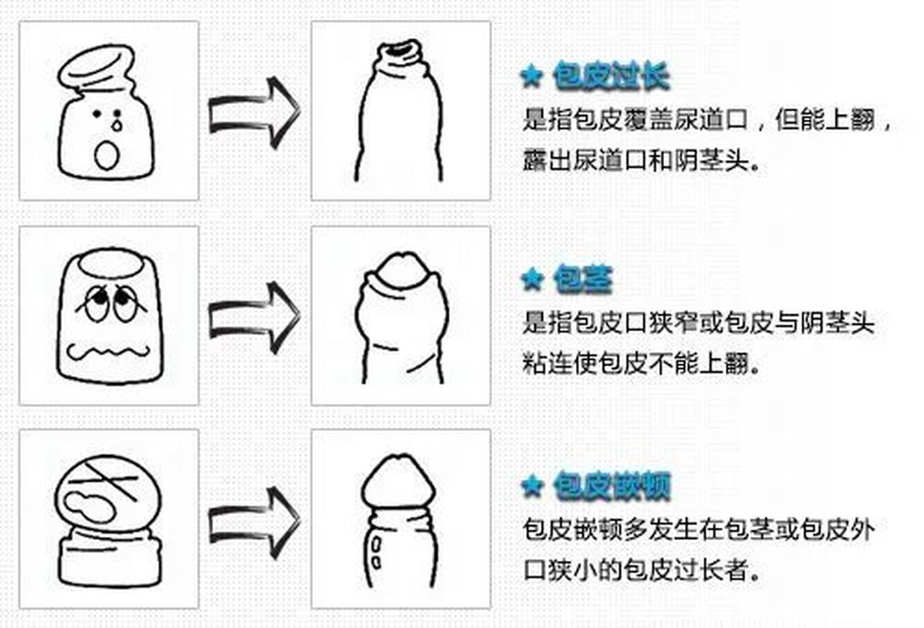 男人的身体下方敏感图片