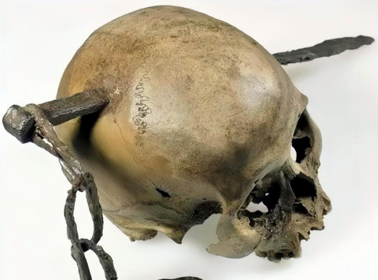 铁钉直接穿过骨头,画面想想就吓人