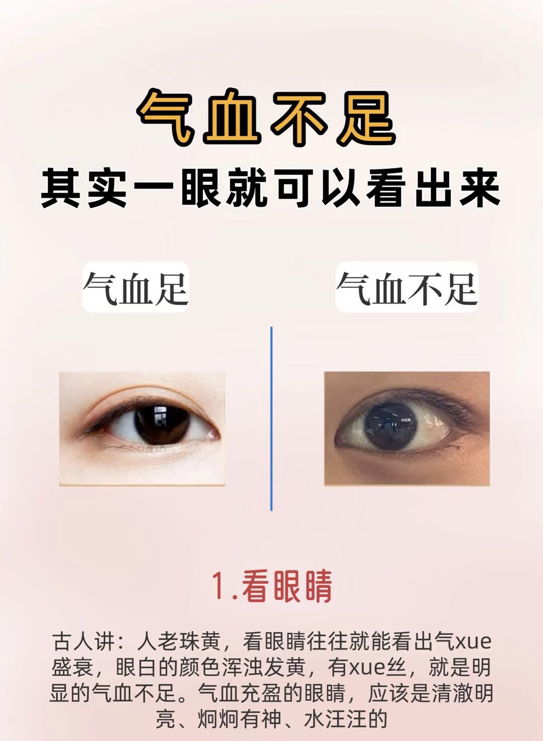 古人讲:人老珠黄,看眼睛往往就能看出气盛衰,眼白的颜色浑浊发黄,有