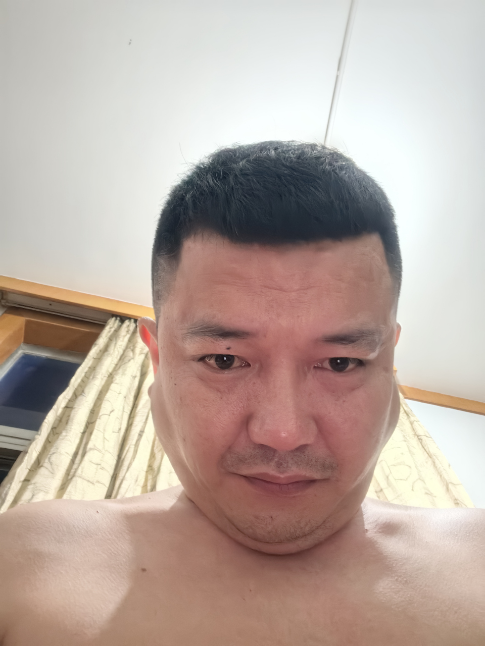 谁告诉我这脸两边多两块肉怎么会事