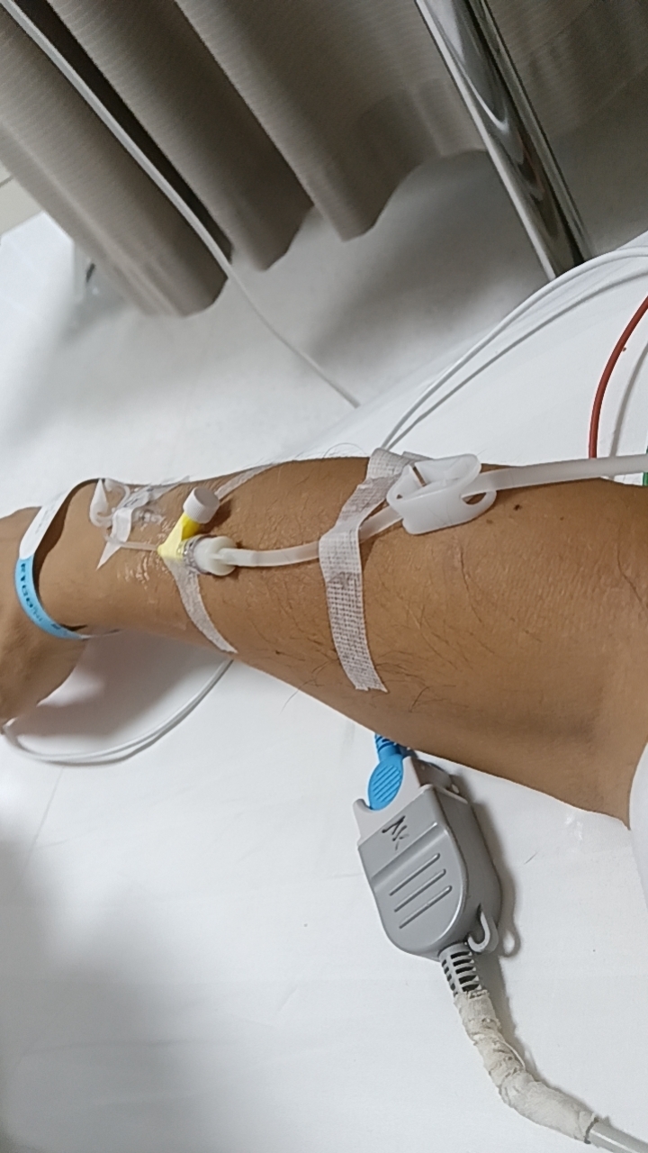 终于熬过第一次化疗,手臂上的止血带痕迹还清晰可见