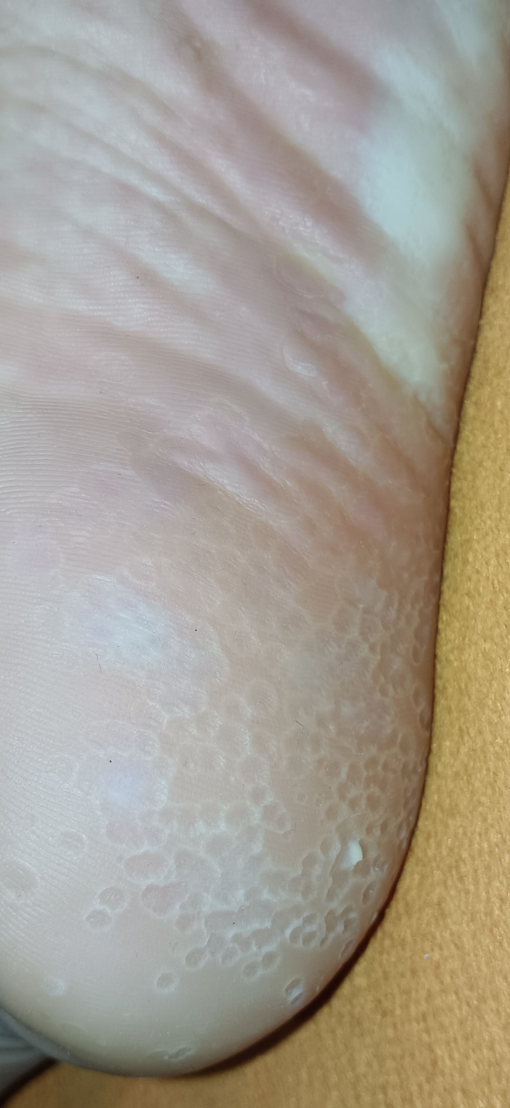 听说这个病很常见,有没有朋友有经验可以分享一下怎么治疗效果好吗?