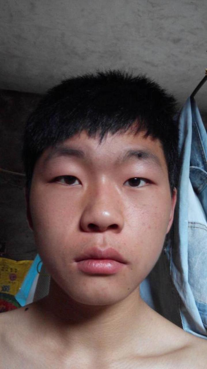 世界上最丑的人