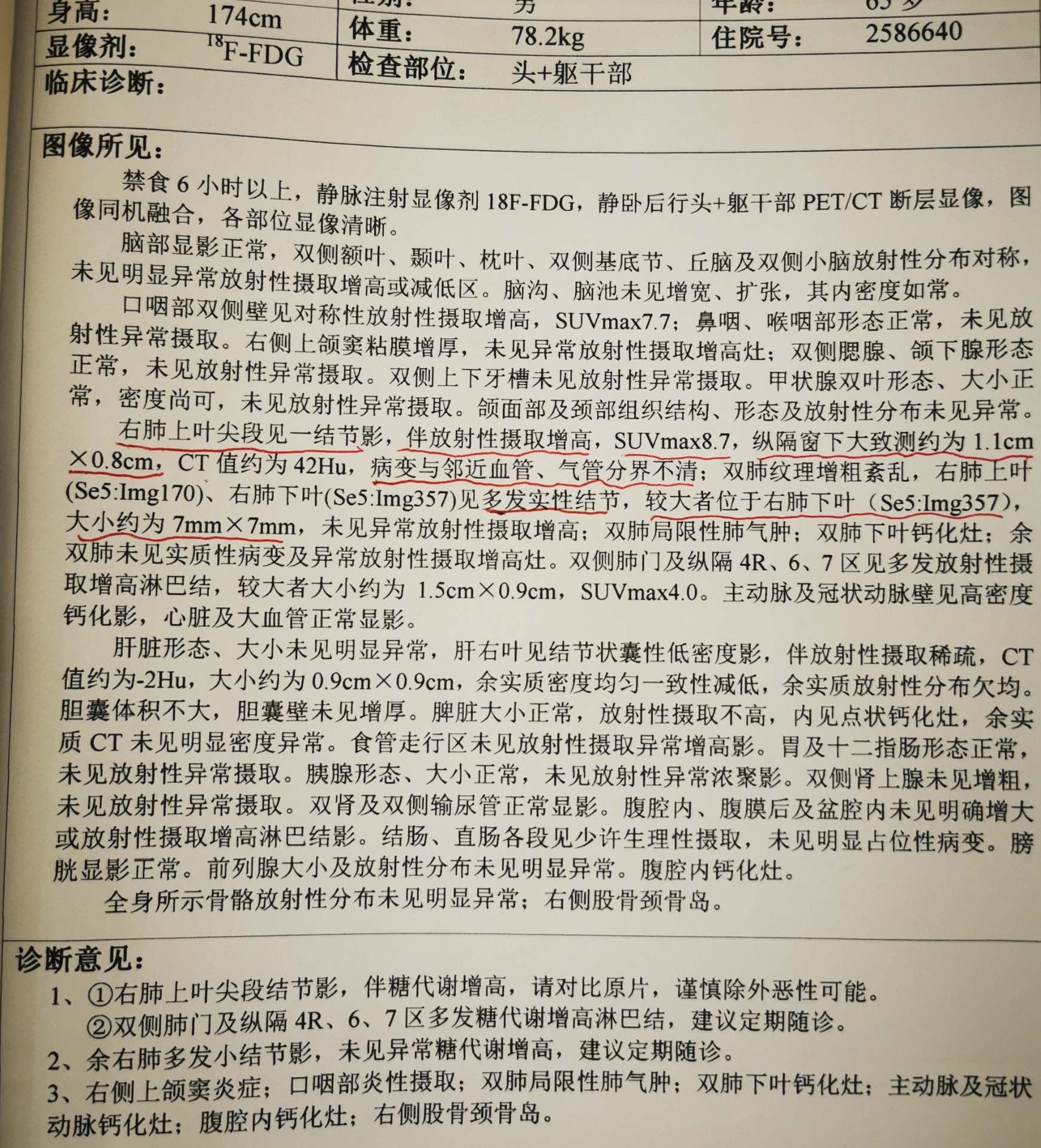 爸爸做的petct显示双侧肺门和纵隔淋巴结代谢增高,还有一个实性肺结节