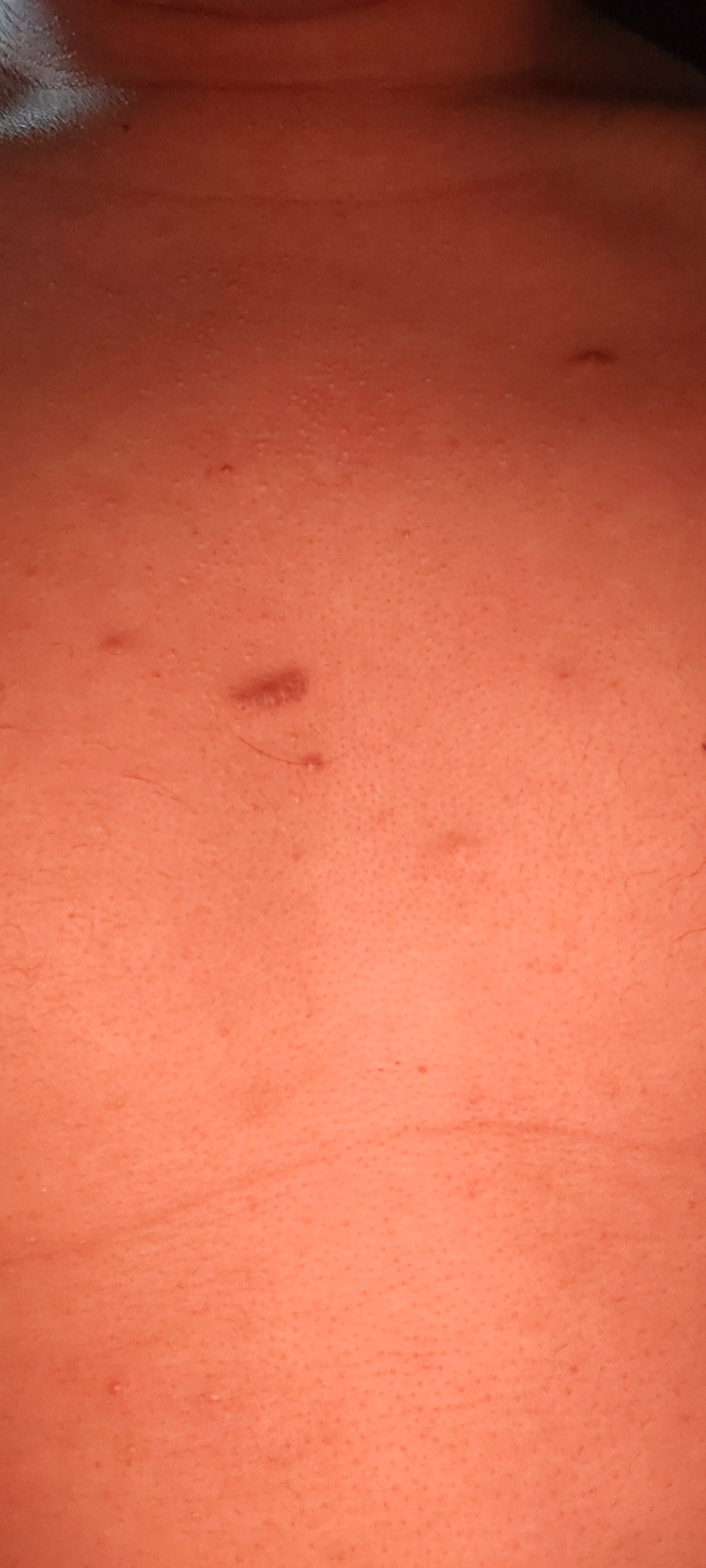 向万能的广大网友咨询一下,在我胸口中间偏左位置的这个