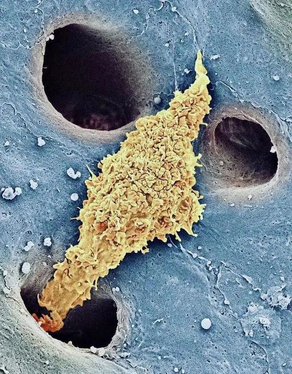 电子显微镜放大2500倍下,人体肝脏中的巨噬细胞