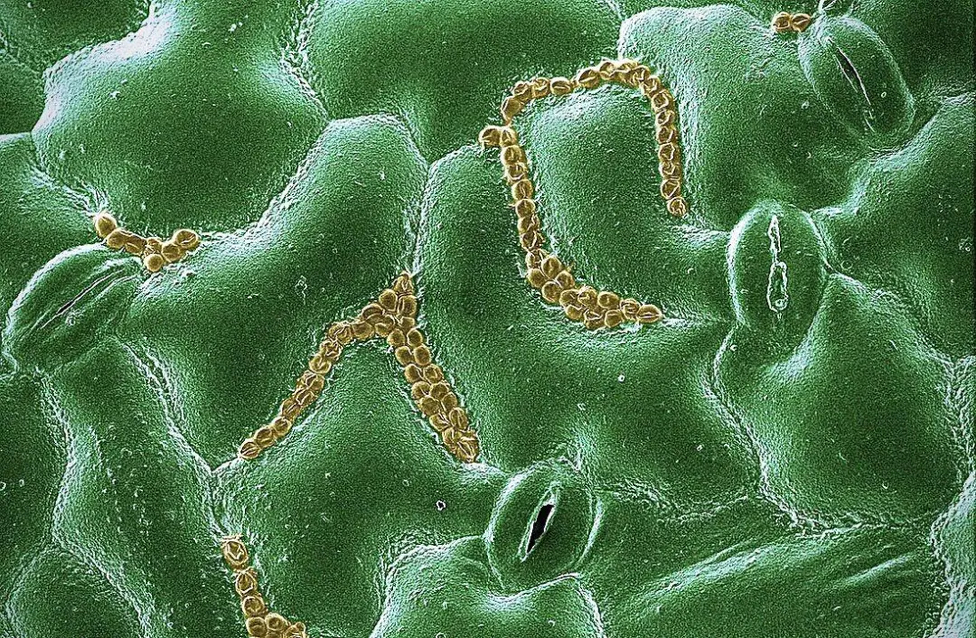 电子显微镜下菠菜叶表面的隐孢子虫卵囊