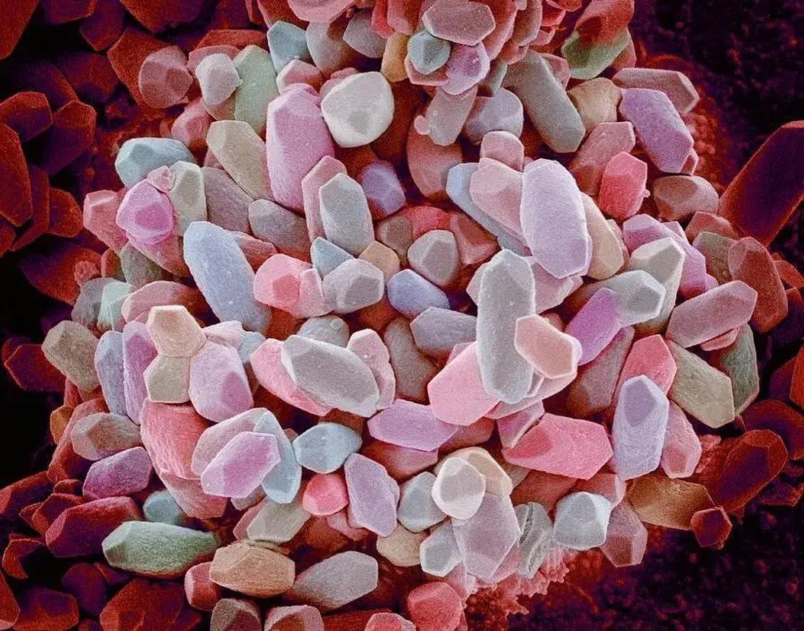 电子显微镜下耳朵内的平衡石